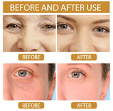 Snail Repair Moisturizer – Hydrates and restores skin